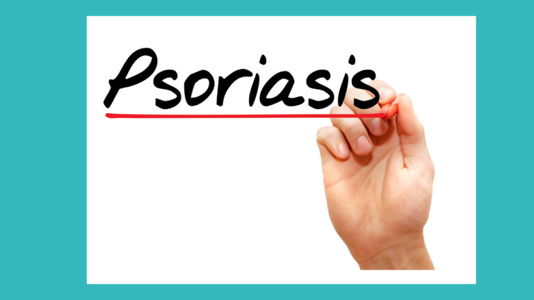 Psoriasis Guide